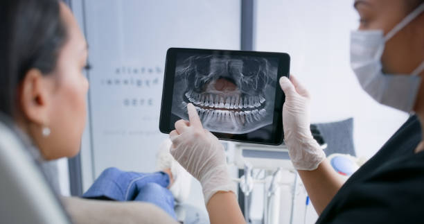 Licensed Teeth Cleaning And Checkup service in Foster City, CA - Smile Center Dentistry