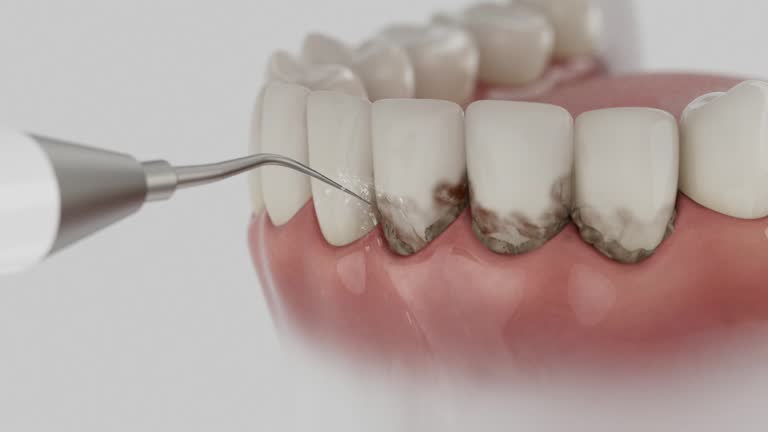 Reliable Teeth Cleaning And Checkup contractor in Foster City, CA by Smile Center Dentistry